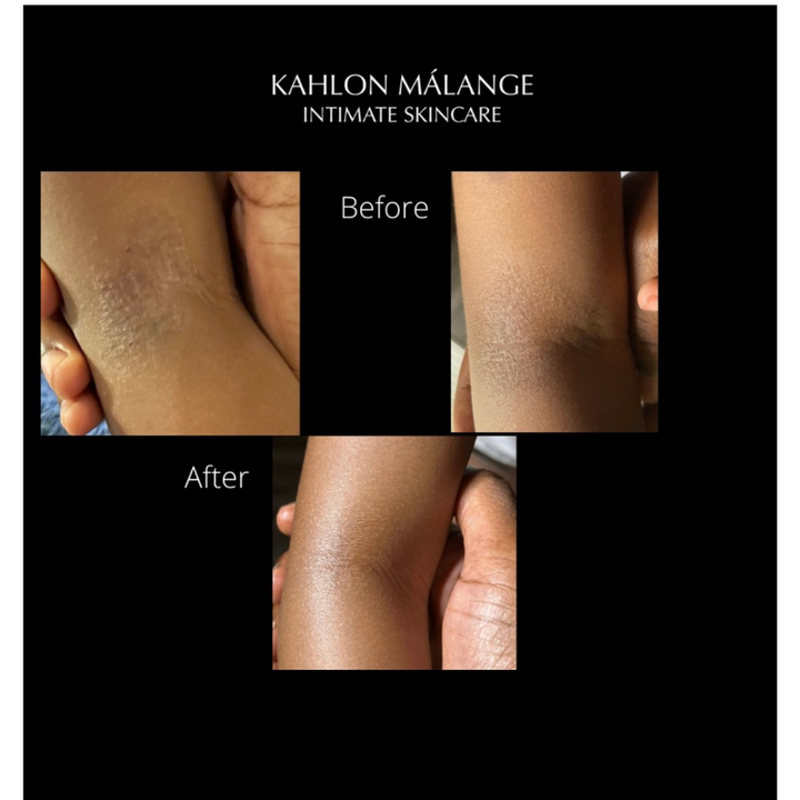 (7 Day Pre Order) 90 Day Armpit Reset Treatment Mask